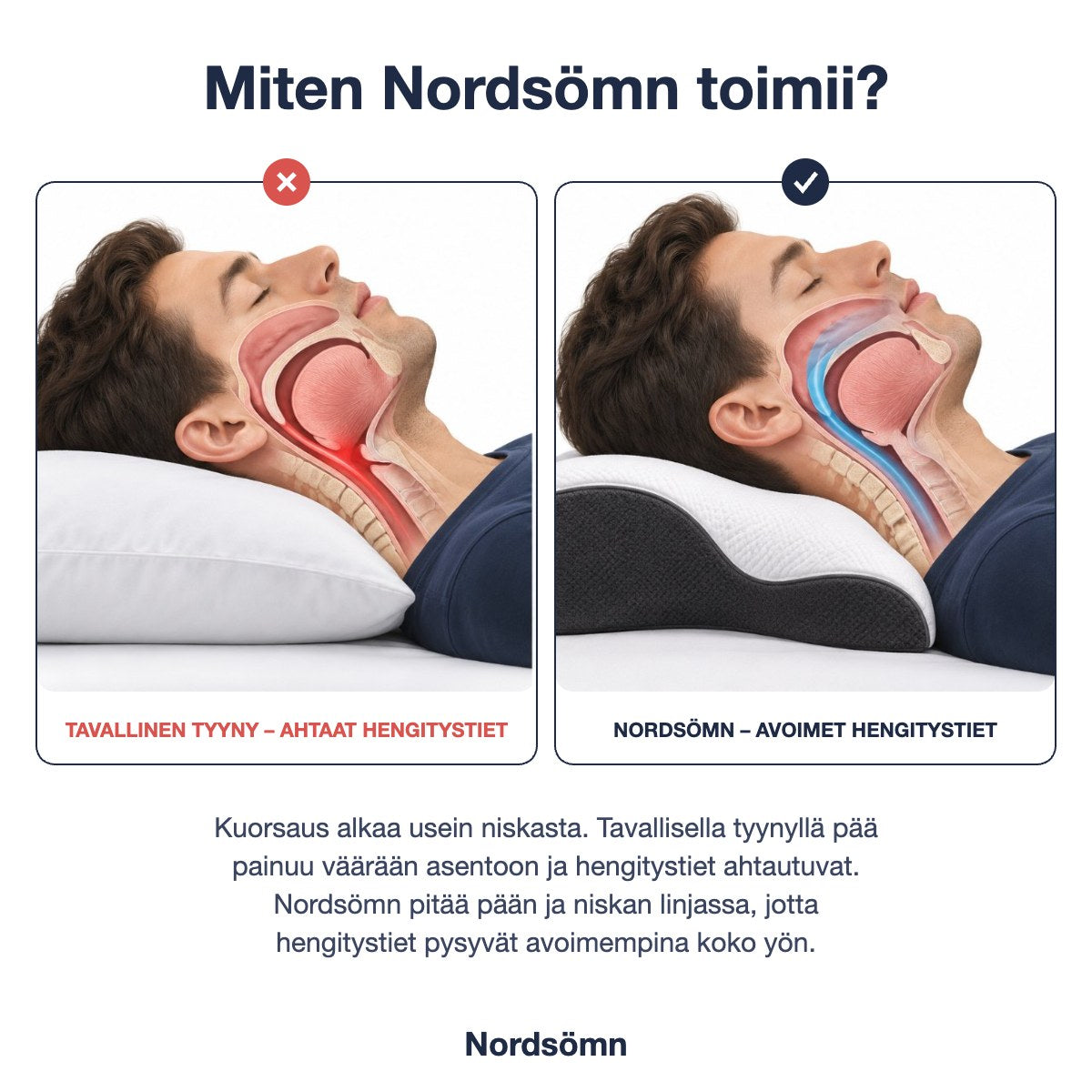 Nordsömn Terapiatyyny